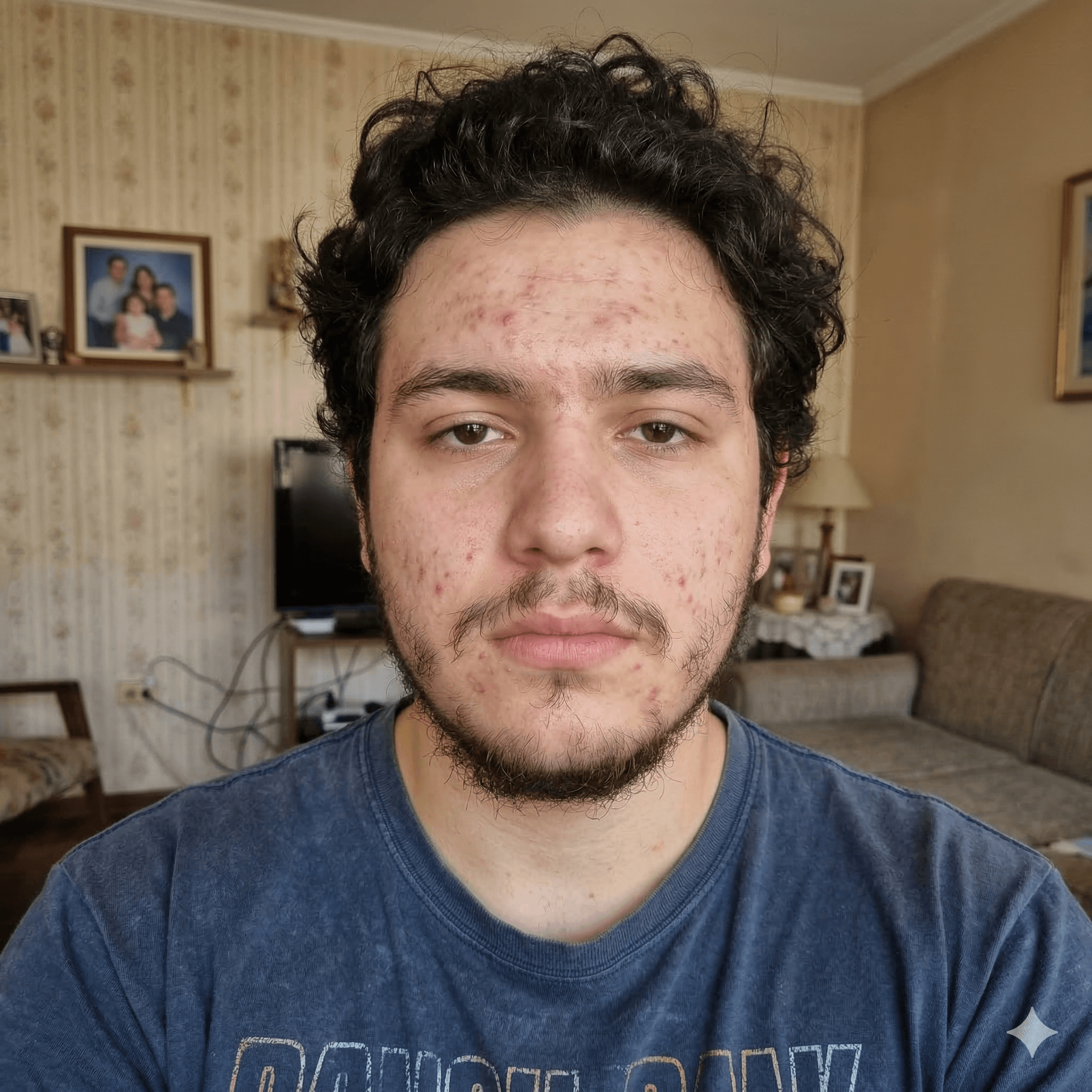 Before — Argentine man